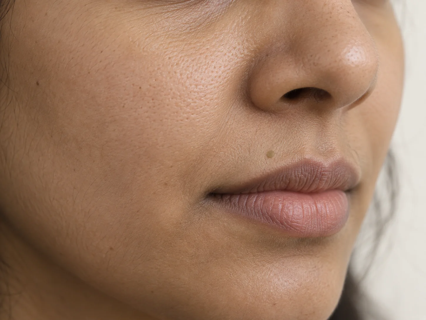 Beauty Spot Creation