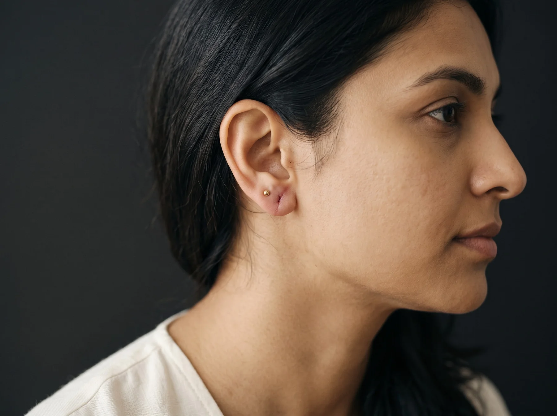 Earlobe Repair & Restoration at Own Skin Dermatology & Advanced Aesthetics, Camp, Pune