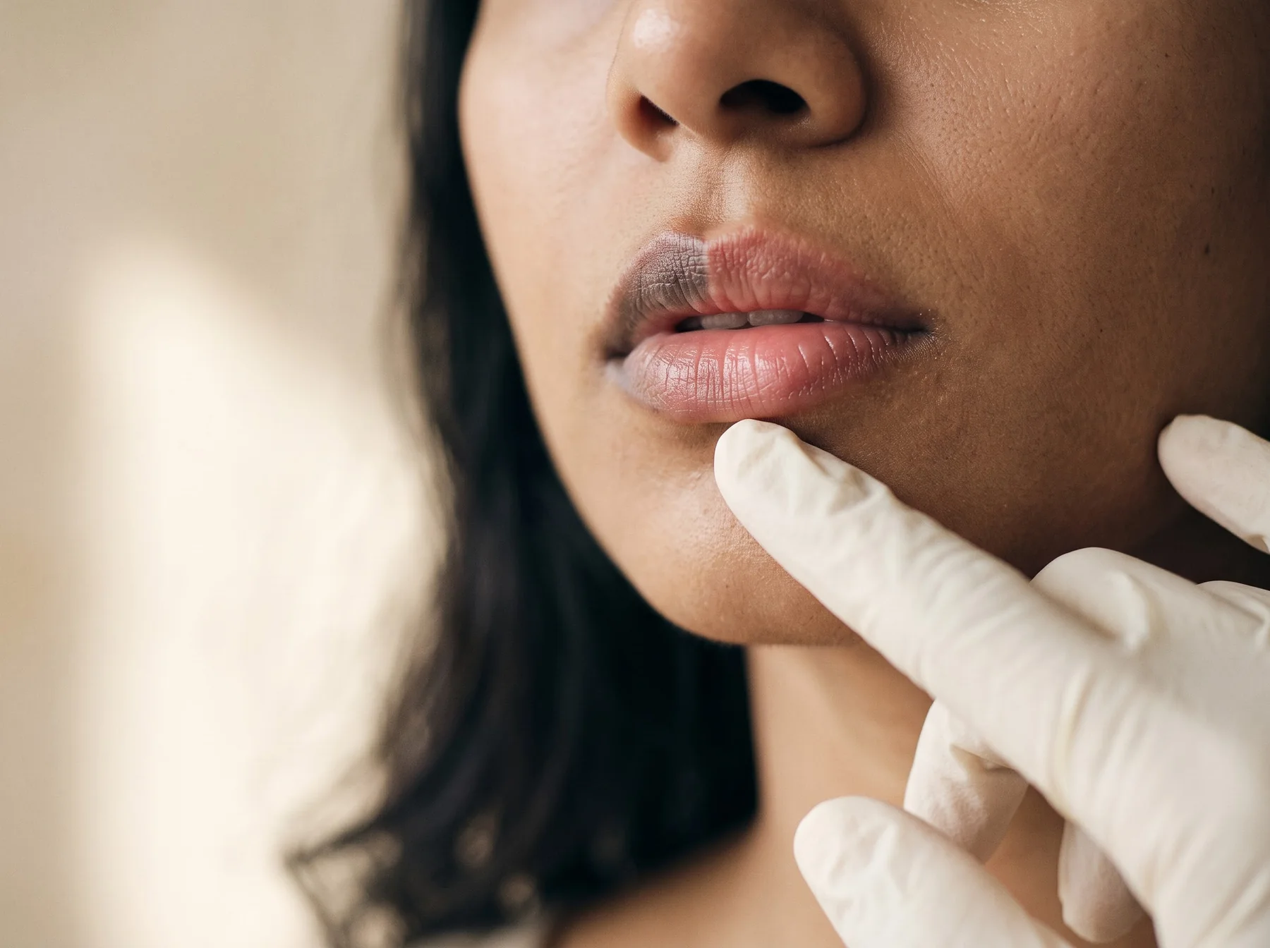 Melanin Softening Lip Treatment