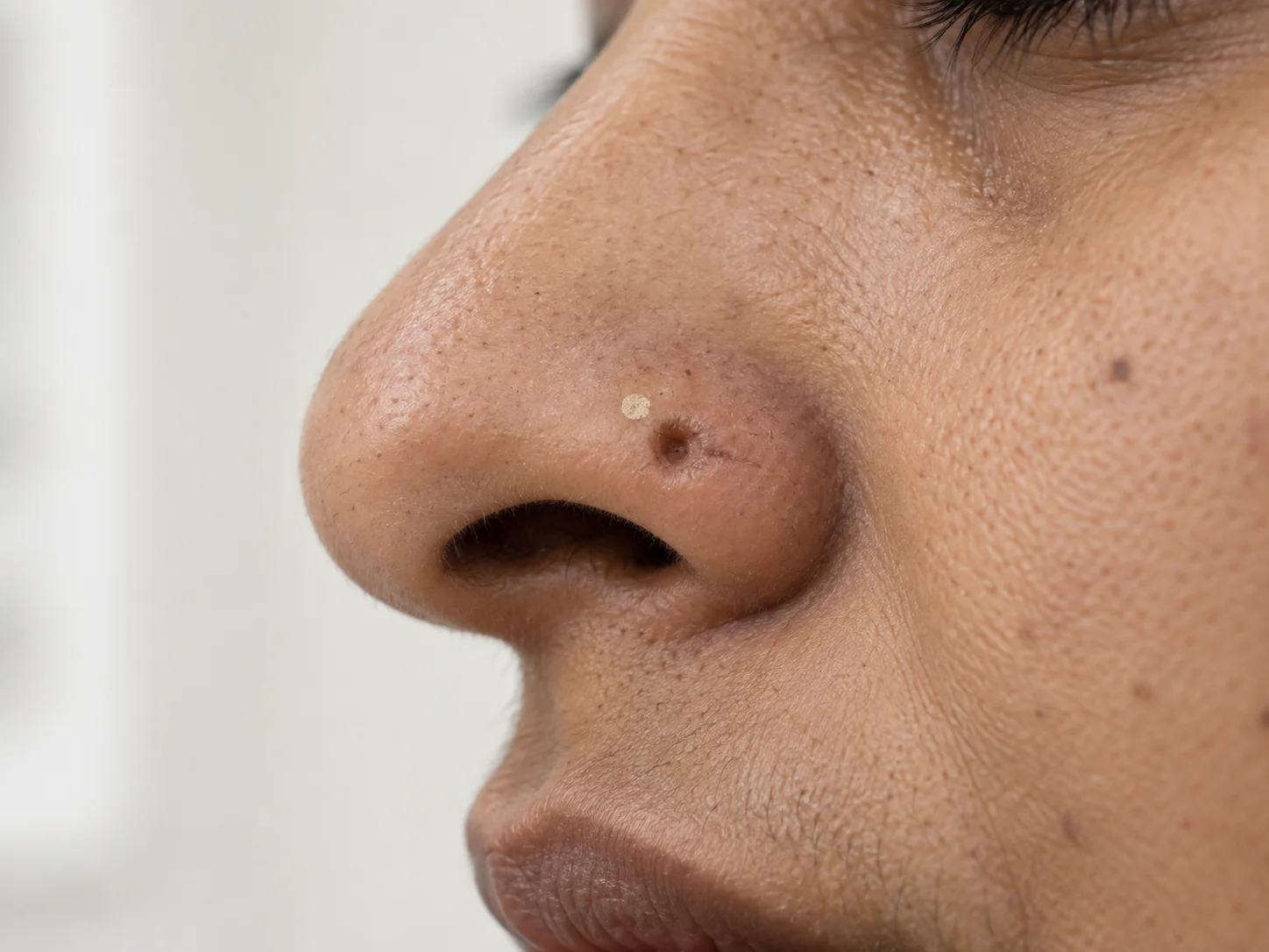 Nose Piercing Repair