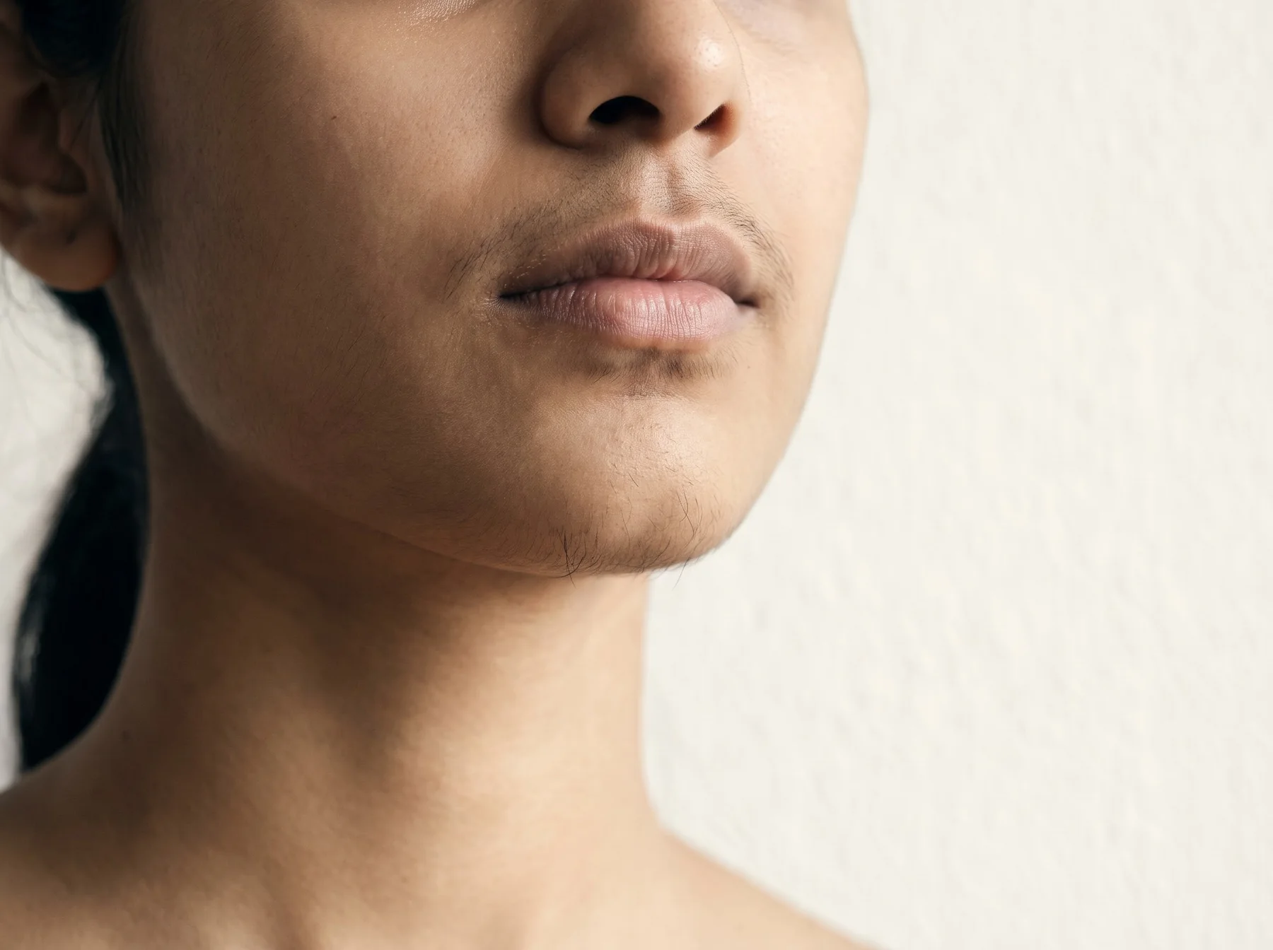 Types of unwanted body & facial hair on Indian skin, dermatologist assessment at Own Skin, Camp, Pune